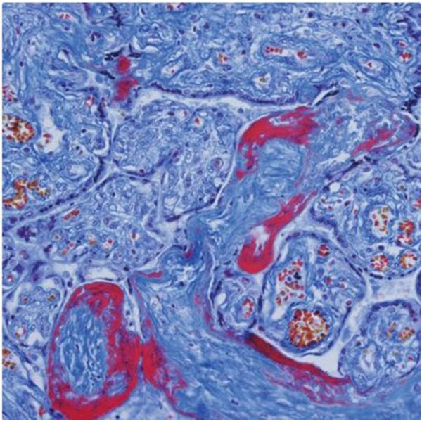 Evident Olympus Mikroskop CX41 do hematologii, bino, ergo, Hal, 40x, 500x, 1000x