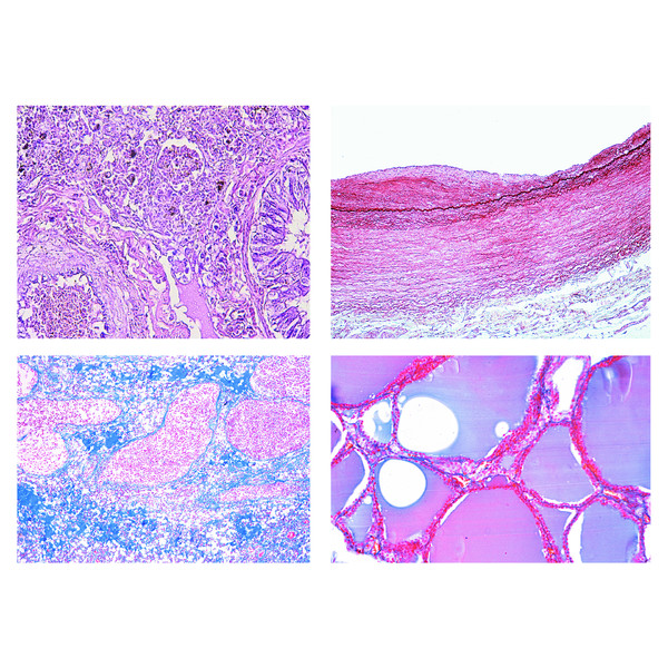 LIEDER Histologia patologiczna człowieka, mała seria (50 preparatów)