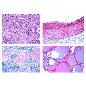 LIEDER Histologia patologiczna człowieka, mała seria (50 preparatów)