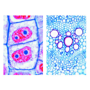 LIEDER Komórki roślinne (cytologia), zestaw studencki podstawowy (6 preparatów)