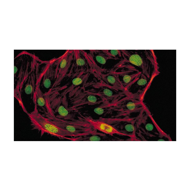 Evident Olympus Mikroskop CX41 fluorescencyjny, trino, Hal, 40x, 100x, 400x