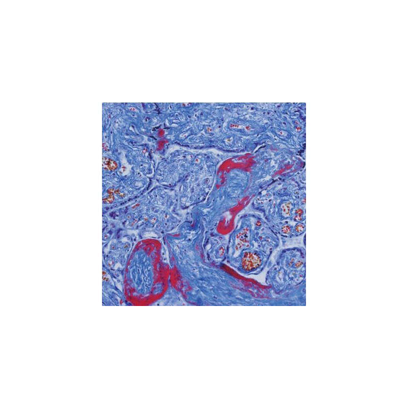 Evident Olympus Mikroskop CX41 do hematologii, bino, ergo, Hal, 40x, 500x, 1000x