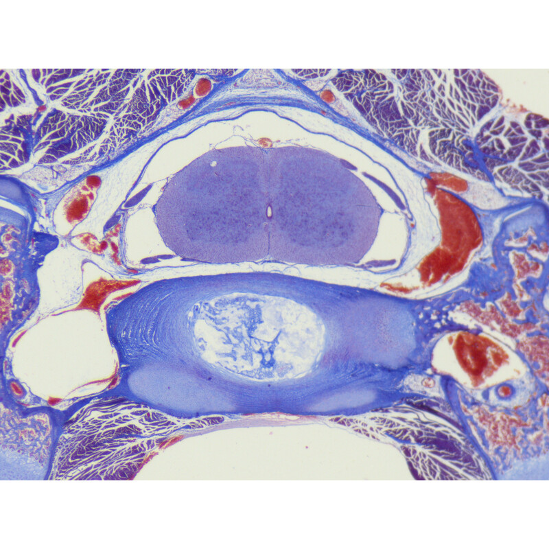 ZEISS Mikroskop stereoskopowy Stemi 355 z zoomem, C Lab, trino, BF, DF, w.d. 110 mm, 10x/23, 5,5:1, 7,2x–40x, AL/DL, Spot C LED